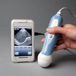 Phone ultrasound